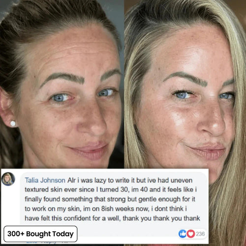 Turn Back Time In 5 Minutes With PDRM Pink Collagen Balm