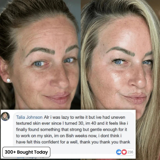 Turn Back Time In 5 Minutes With PDRM Pink Collagen Balm